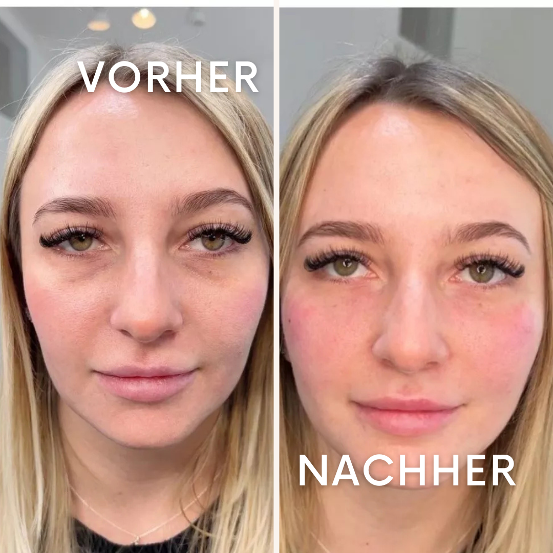 CuraDew: Die Rettung für müde Augen