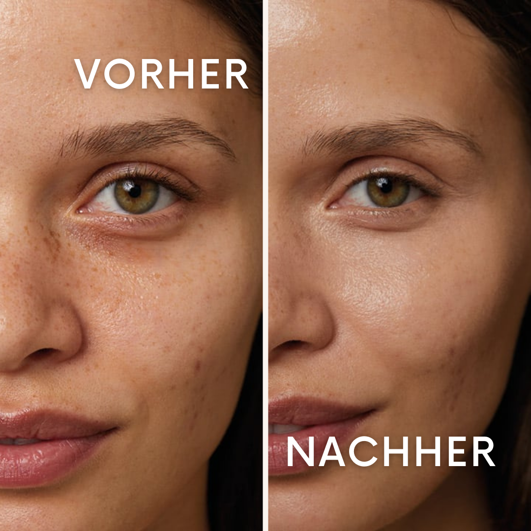 CuraDew: Die Rettung für müde Augen