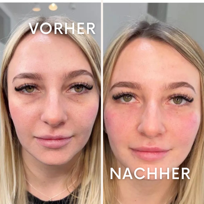 CuraDew: Die Rettung für müde Augen