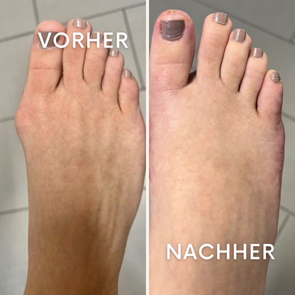 StridaFit: Dein Schutzschild für den Knöchel