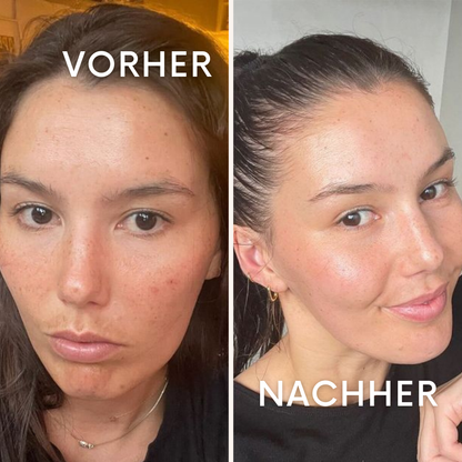 DewyMask: Strahlende Haut über Nacht