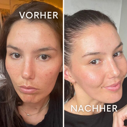 GlowWrap: für eine jugendlich straffe Haut!