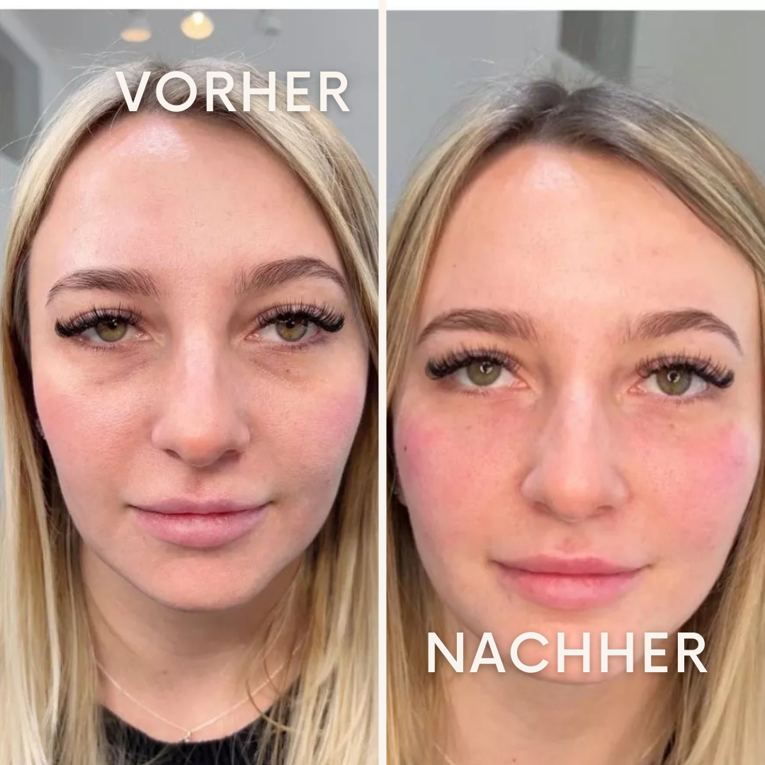 GlowWrap: für eine jugendlich straffe Haut!