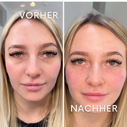 GlowWrap: für eine jugendlich straffe Haut!