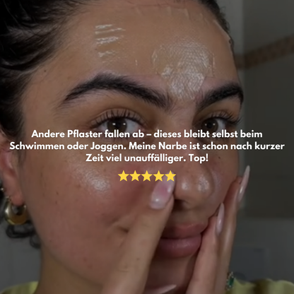 ScarEase: Die unsichtbare Lösung für deine Narben