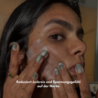 ScarEase: Die unsichtbare Lösung für deine Narben