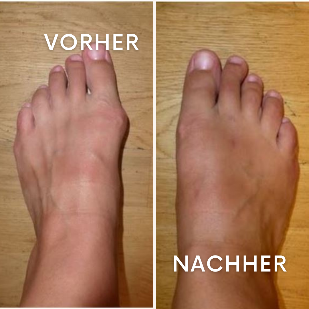 AnkleEase: Linderung für schmerzende Knöchel