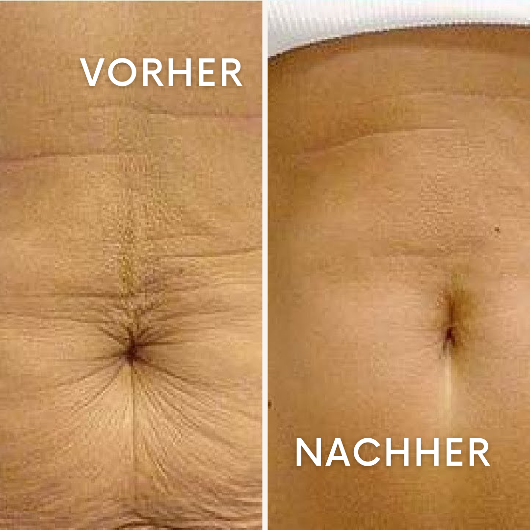 FrostEase: Die Rettung nach der Geburt