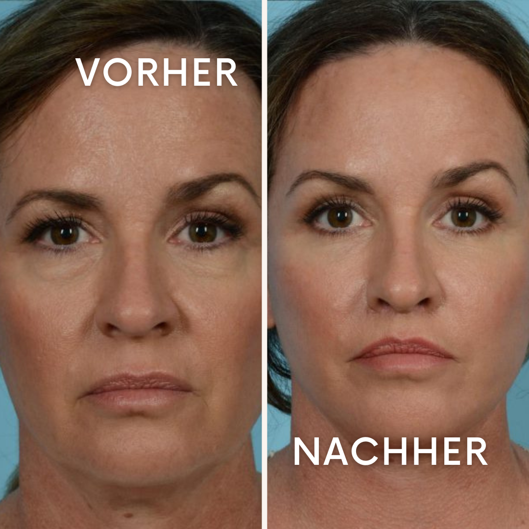 AuraGlow: Geheimnis jugendlicher Haut!