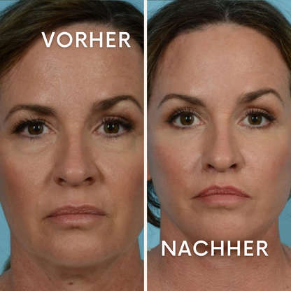 AuraGlow: Geheimnis jugendlicher Haut!