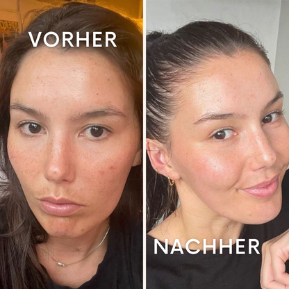 GlowFusion: Deine Beauty-Rettung