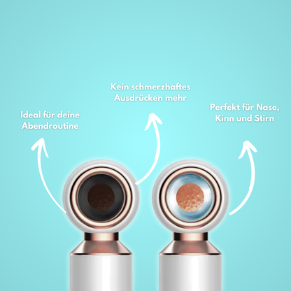 PoreNova: Ready für saubere Haut?