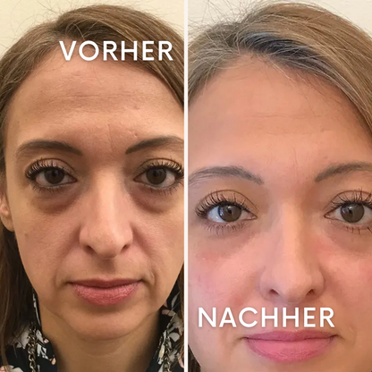 HydraGlow: Mach Schluss mit Augenringen