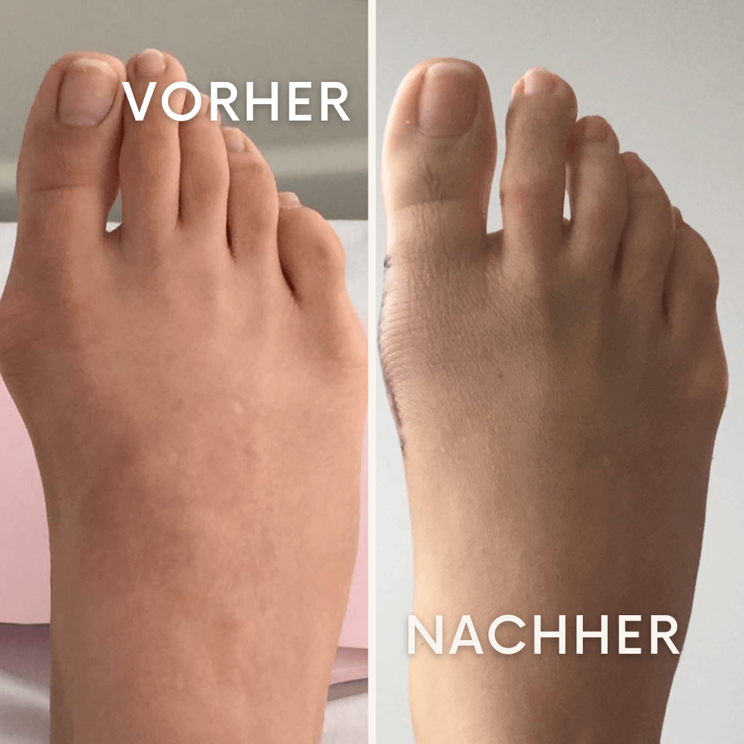 PulseBrace: Der Gamechanger für deinen Fuß.