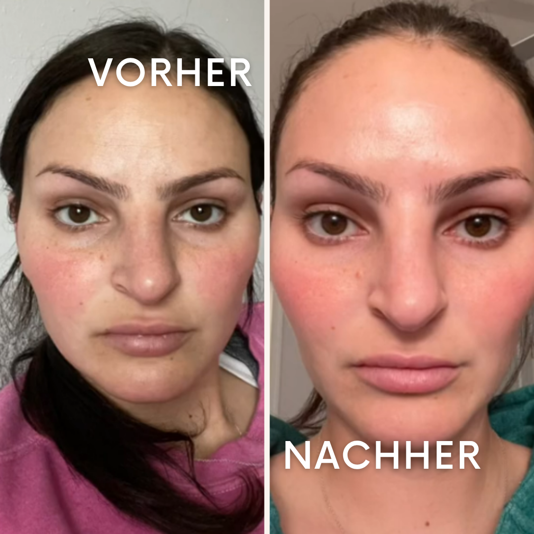 VibraStone: Dein persönlicher Therapeut für zu Hause