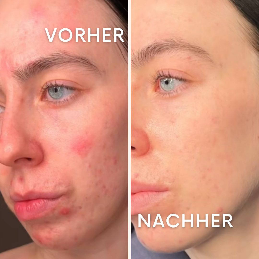 IonPool: Clevere Poolreinigung