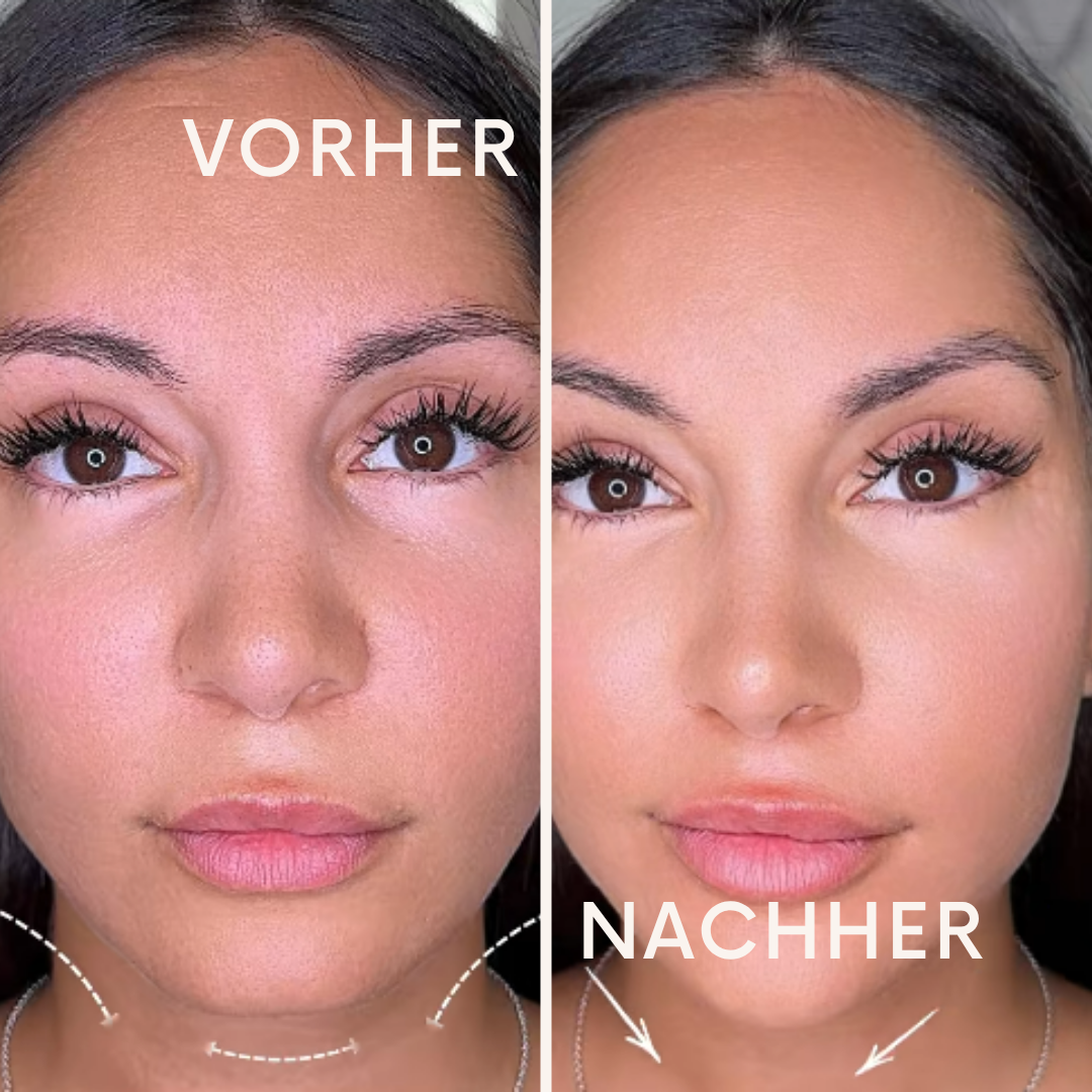 Elysskin: für klare Konturen und Detox Effekt