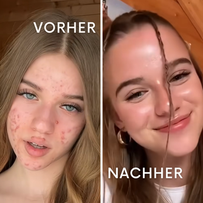 AeroSkin: deine smarte Spa Routine für zuhause