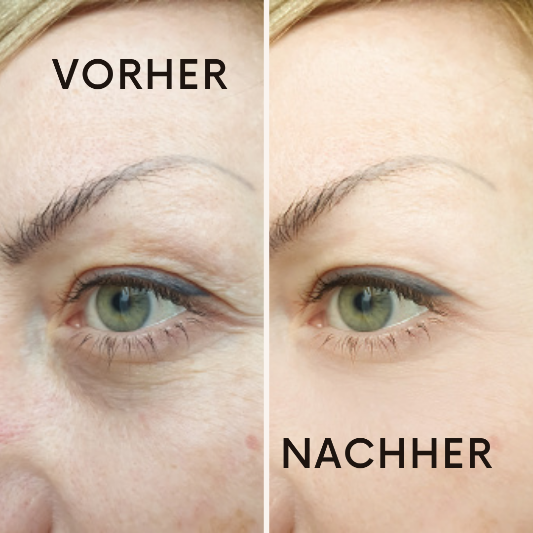 Firmea: für straffe, jugendliche Haut