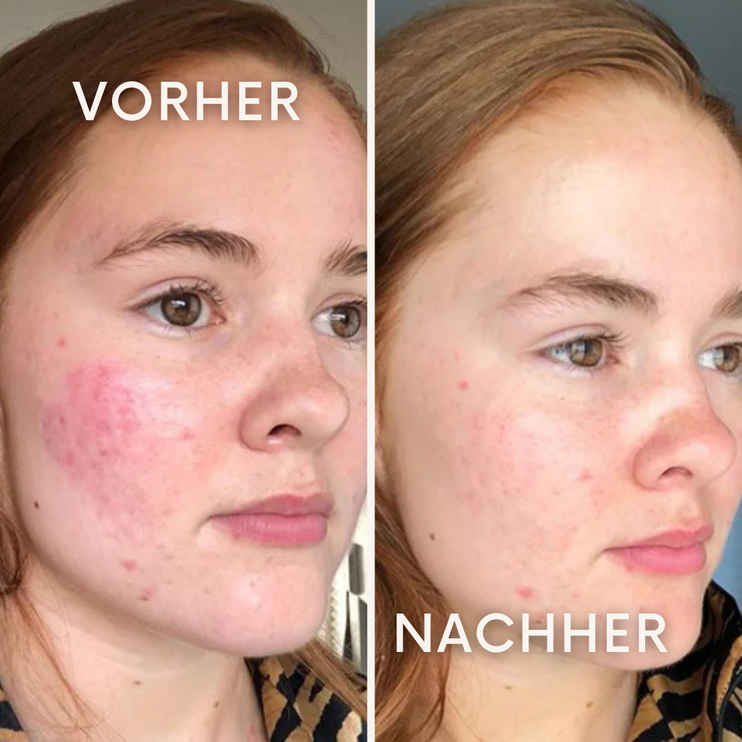 AquaPulse: bringt deine Haut zum Strahlen