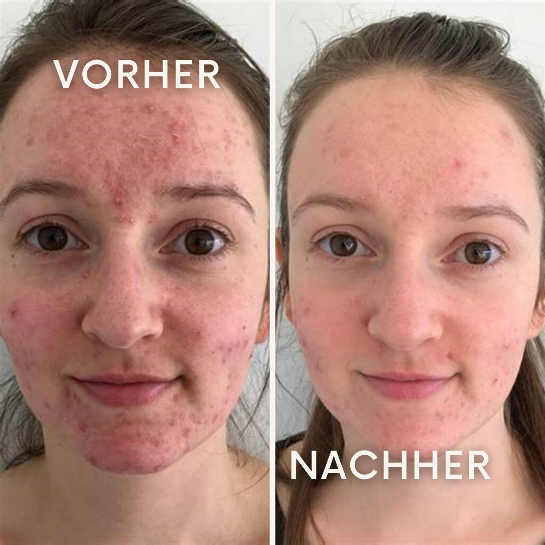 AquaPulse: bringt deine Haut zum Strahlen