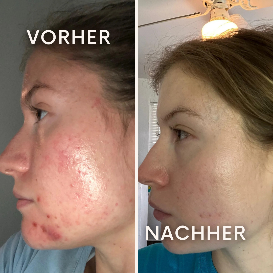 AquaPulse: bringt deine Haut zum Strahlen