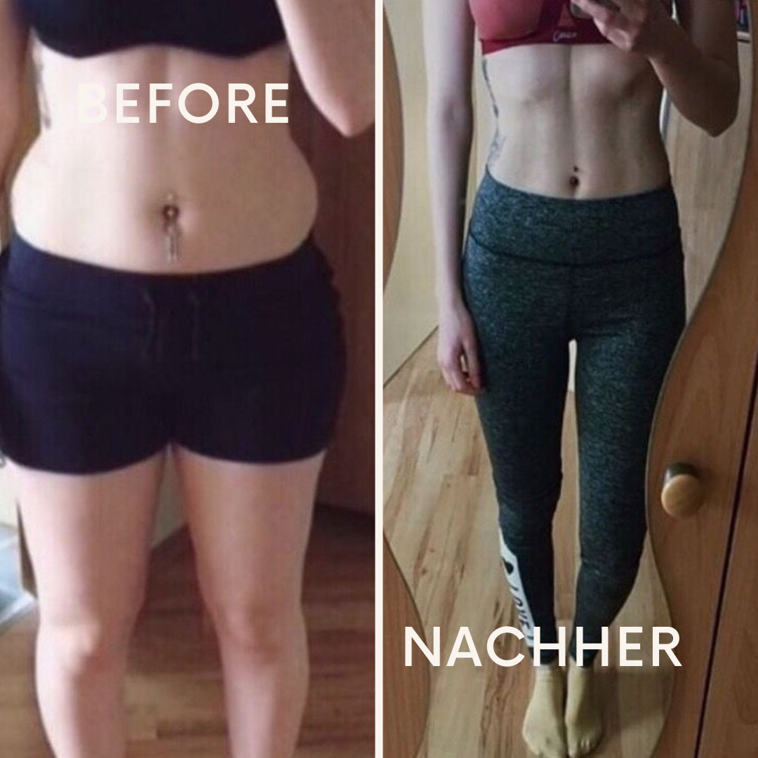 TrimFit Neopren