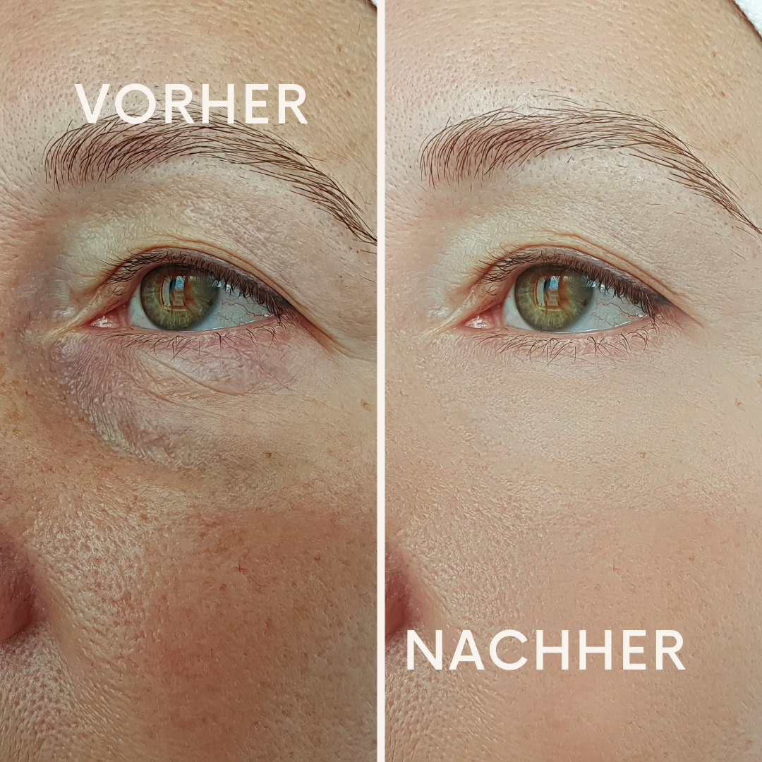 LuminEye: Augen die strahlen