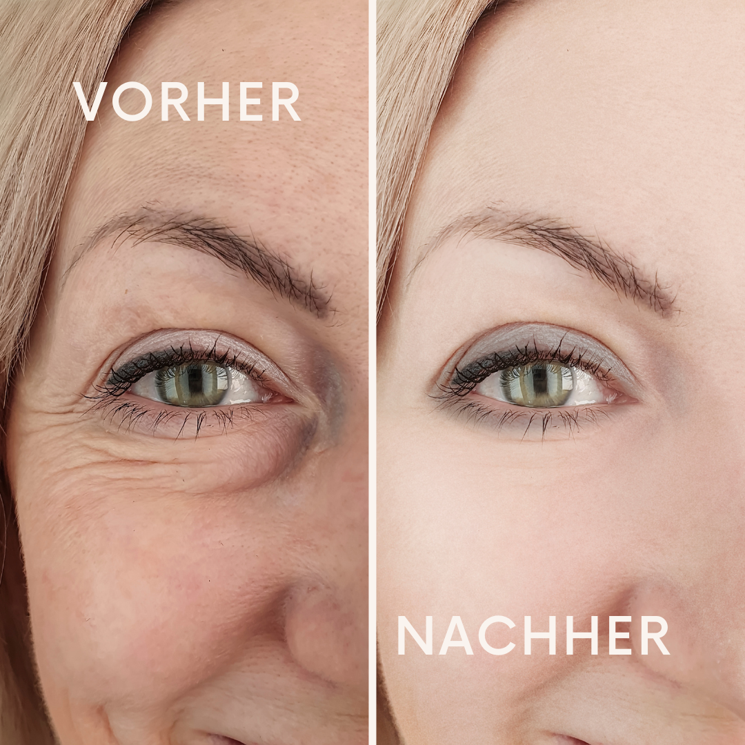 LuminEye: Augen die strahlen