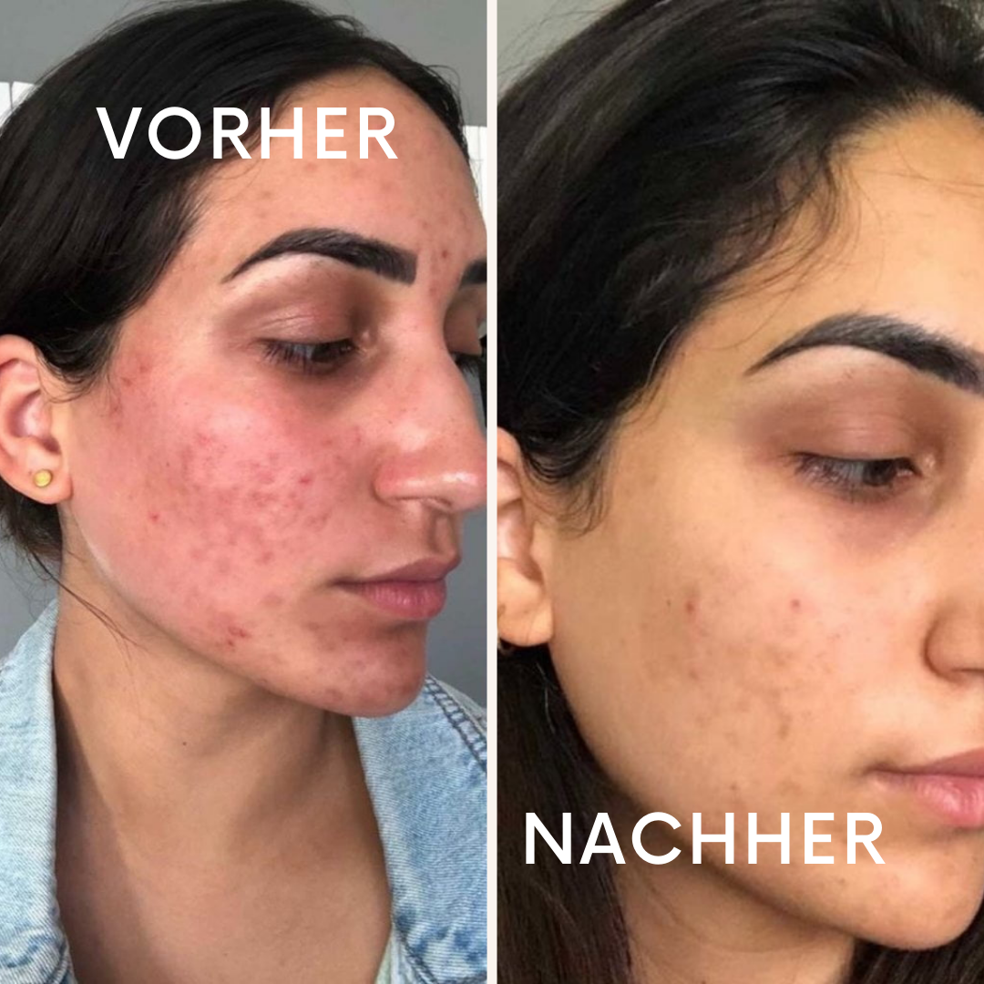 LivSkin