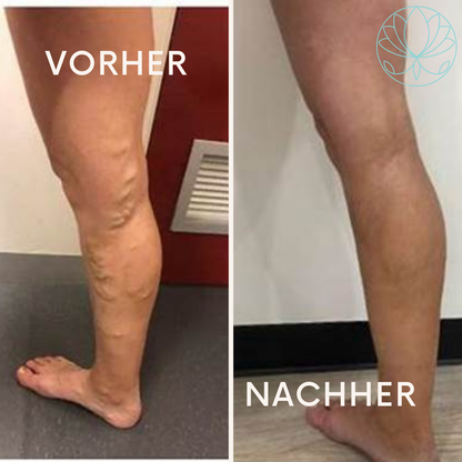 PulseEase: Des Geheimnis für deine Bein Entspannung